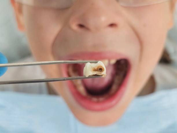 Best Walk-In Emergency Dental Services in Brookdale, SC